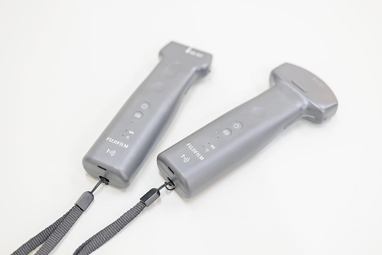 ワイヤレス超音波画像診断装置