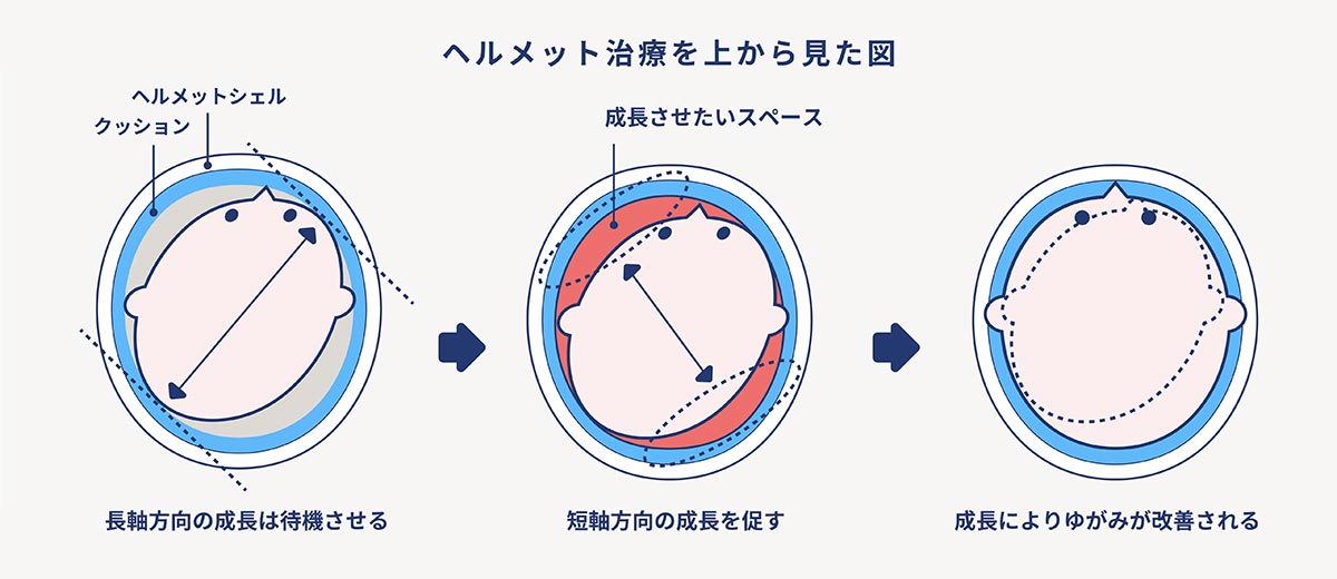あたまが痛い